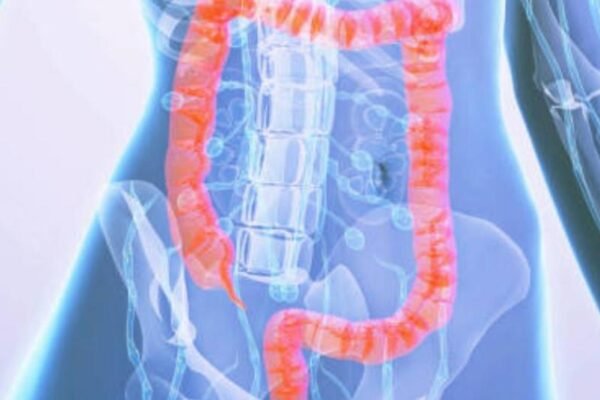 Las frutas que ayuda a limpiar el colon y mejorar la digestión, según expertos