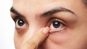 ¿Sientes molestias en los ojos? El polvo del Sahara y el calor podrían ser los culpables